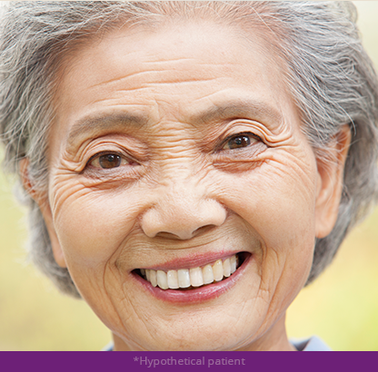 Alcon Glaucoma Medication Copay Card