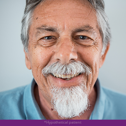 Alcon Glaucoma Medication Copay Card